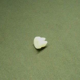 Respot Finger Glide Insert (Aluminum Table)